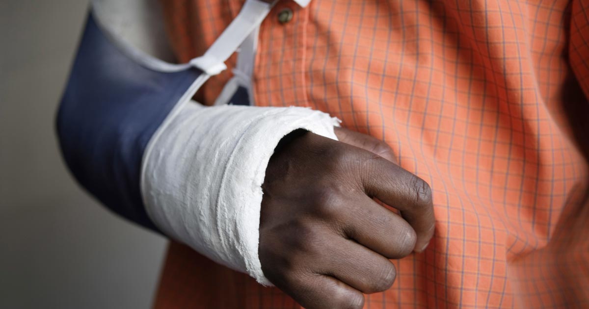 Man wearing a cast in a sling